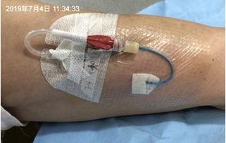 成人肛门清理视频教程